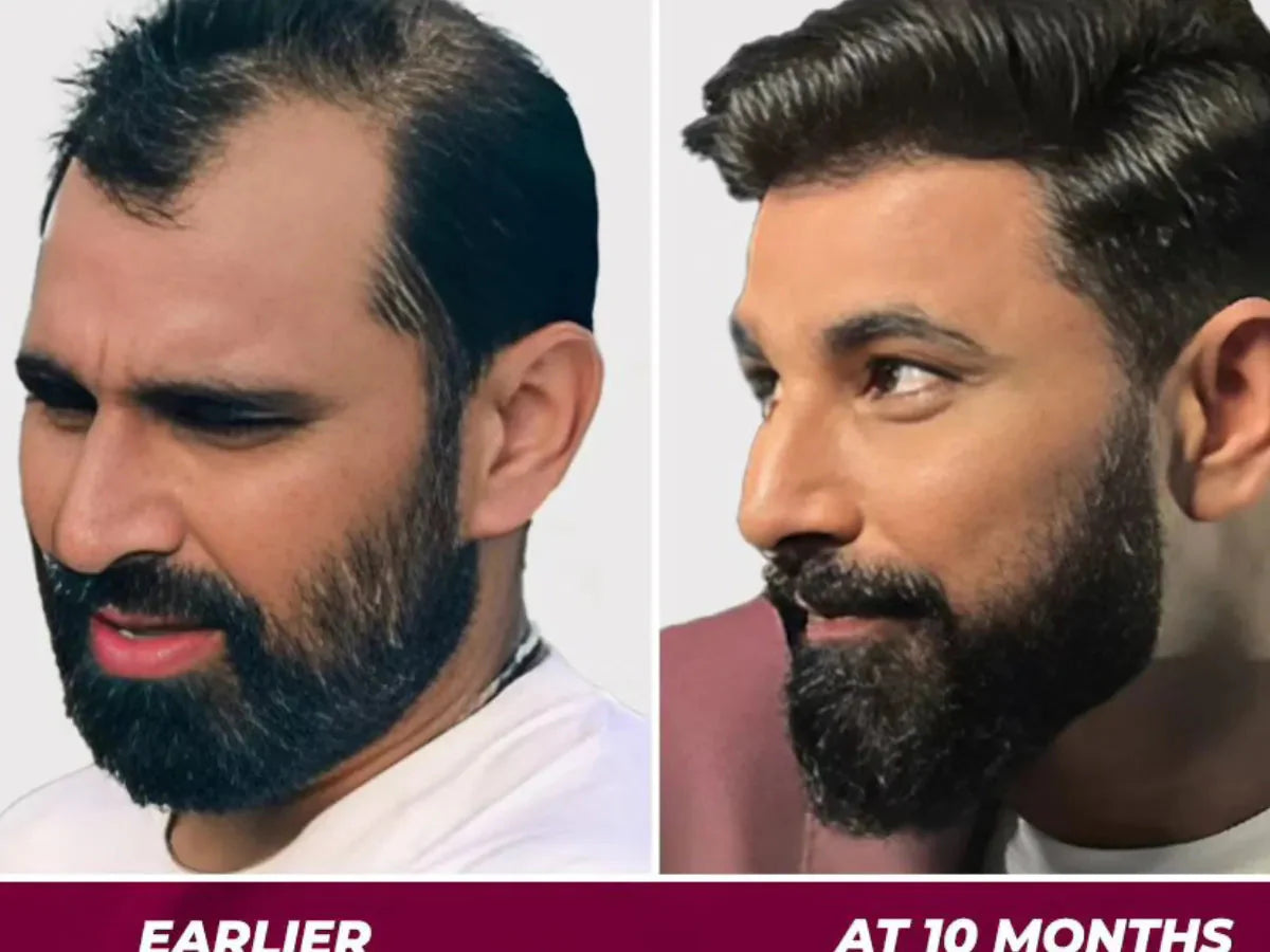 🔥 Jamalgota Ayurvedic Hair Growth Powder Buy 1 Get 1 Free 🔥🌿
